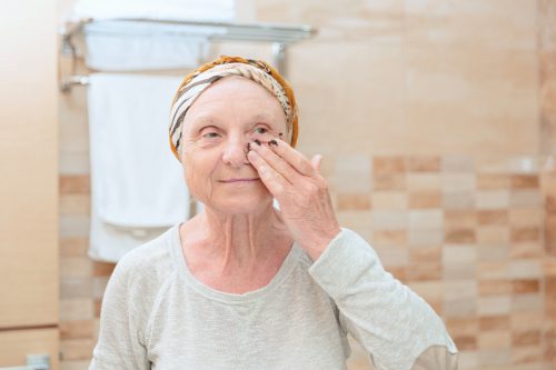 skin issues in assisted living